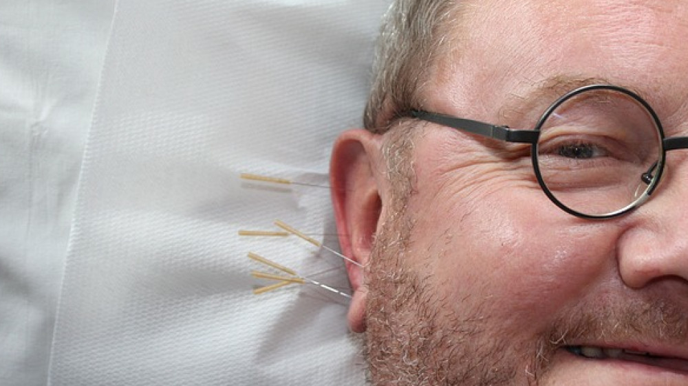 Als individuelle Gesundheitsleistung gilt beispielsweise Akupunktur, etwa zur Migräneprophylaxe.
